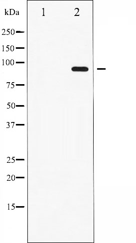 p-STAT6 (T645) Ab