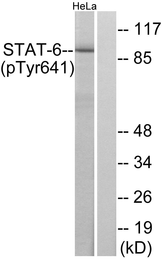 p-STAT6 (Y641) Ab