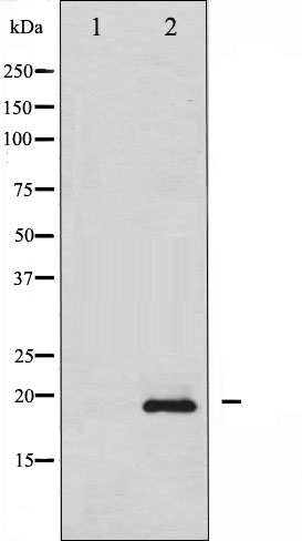 p-Stathmin 1 (S15) Ab