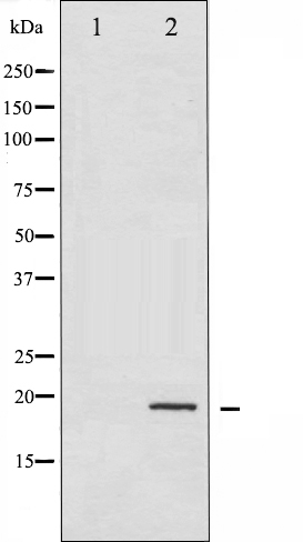 p-Stathmin 1 (S24) Ab