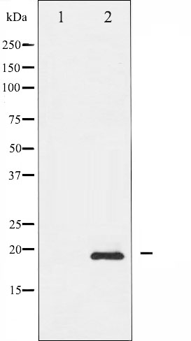 p-Stathmin 1 (S37) Ab