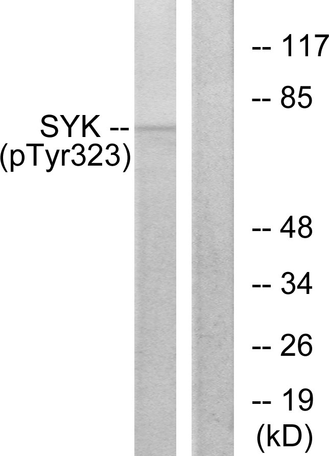 p-Syk (Y323) Ab