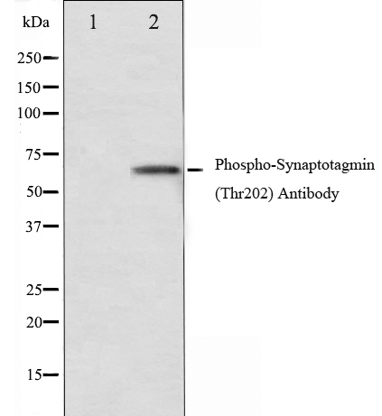 p-Synaptotagmin 1 (T202) Ab