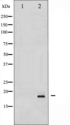 p-alpha Synuclein (S129) Ab