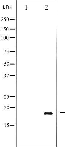 p-alpha Synuclein (Y136) Ab