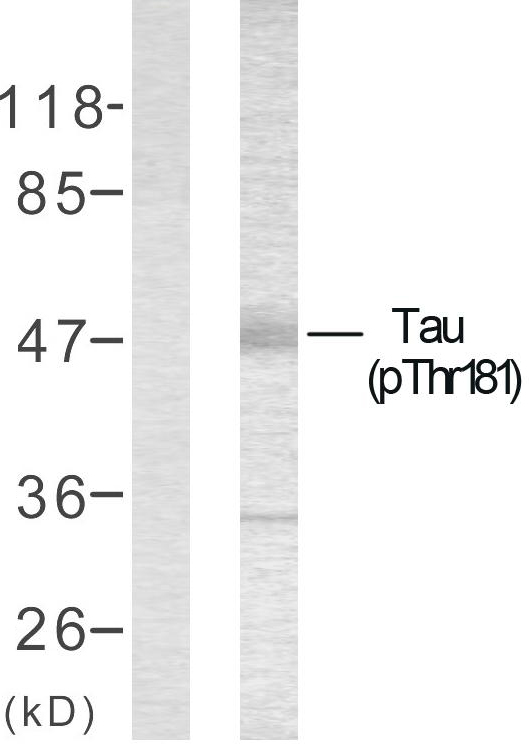 p-Tau (T181) Ab