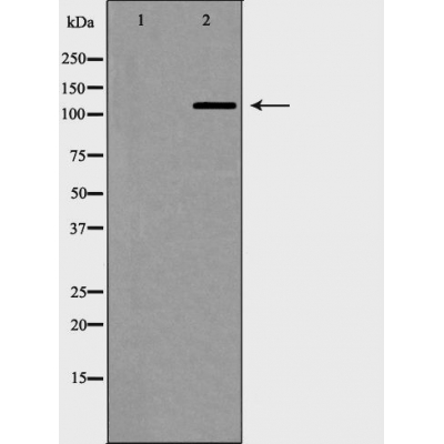 p-TERT (S824) Ab