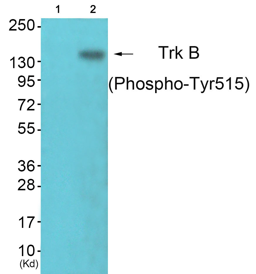 p-Trk B (Y516) Ab