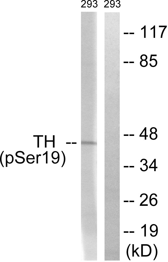 p-Tyrosine hydroxylase (S19) Ab