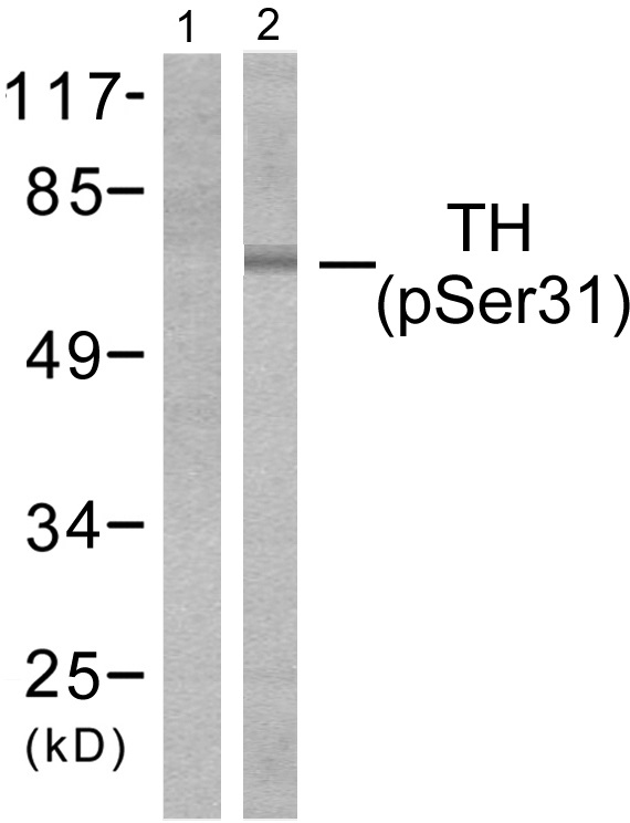 p-Tyrosine hydroxylase (S31) Ab