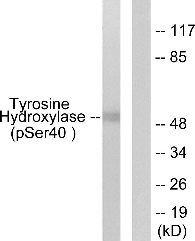 p-Tyrosine hydroxylase (S40) Ab