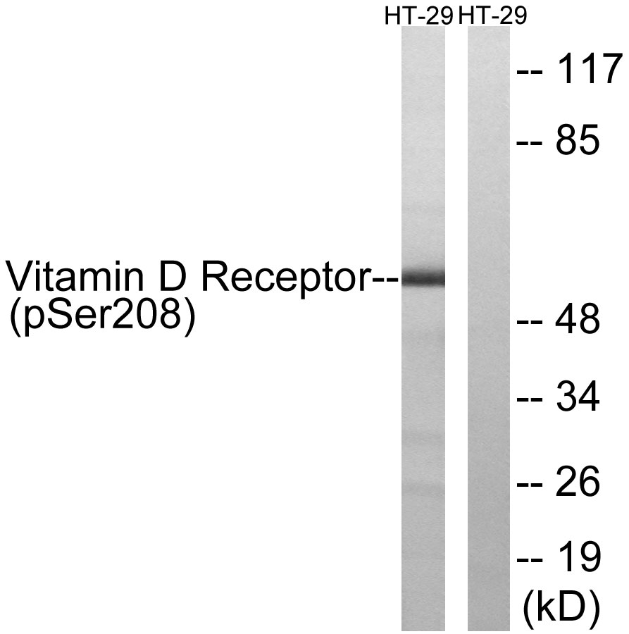 p-Vitamin D3 receptor (S208) Ab