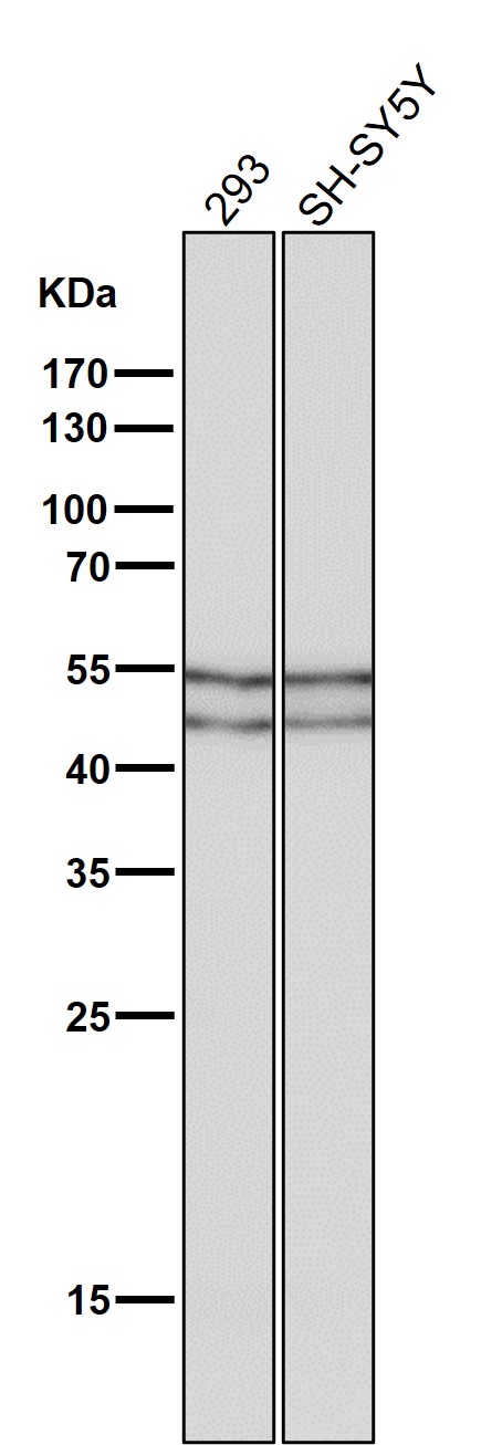 p-GSK3 alpha/beta (Y279/Y216) Ab