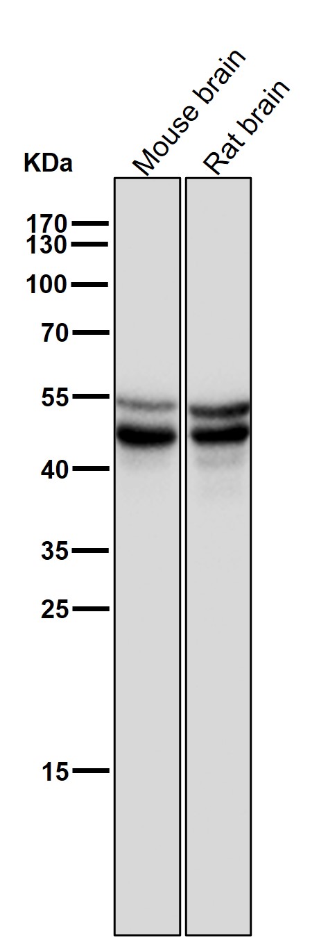 p-GSK3 alpha/beta (Y279/Y216) Ab