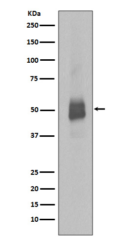 p-Lyn (Y396) Ab