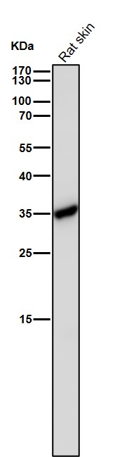 Caspase 6 Ab