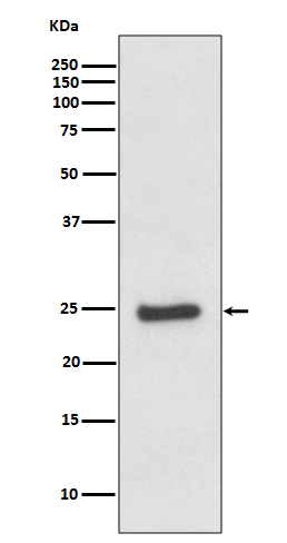 ZNRF2 Ab