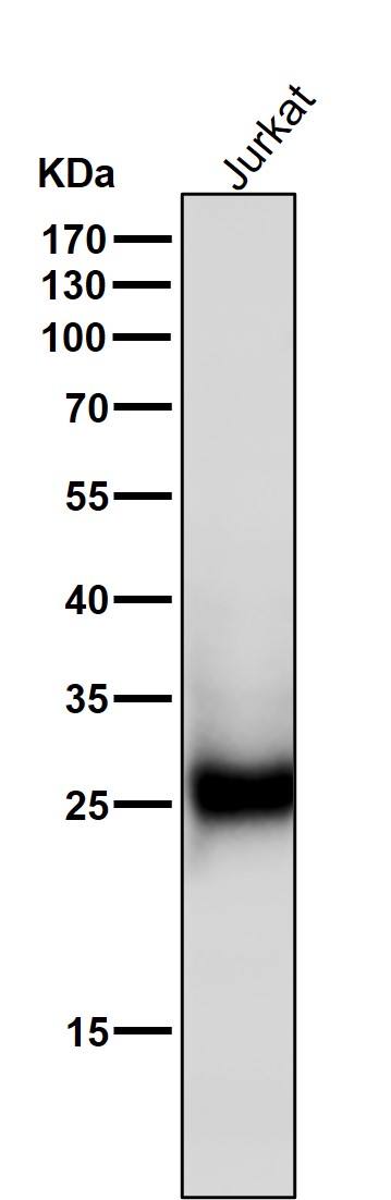 ZNRF2 Ab