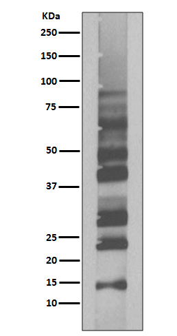 K63-linkage specific ubiquitin Ab