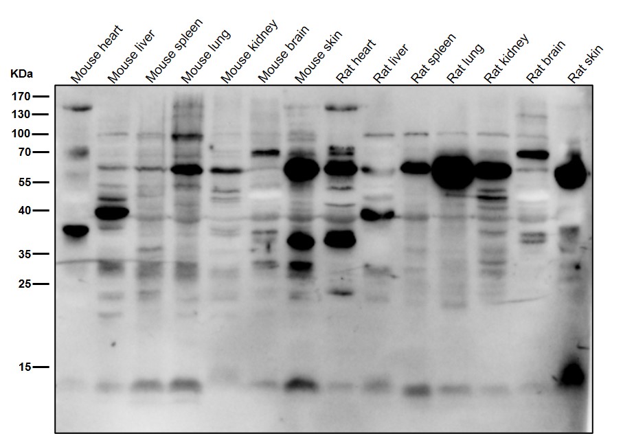 K63-linkage specific ubiquitin Ab