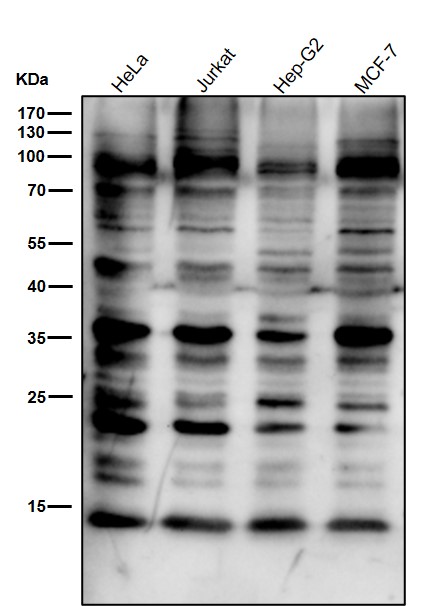 K63-linkage specific ubiquitin Ab