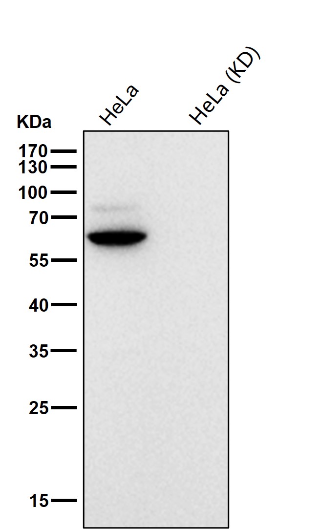 E2F1 Ab