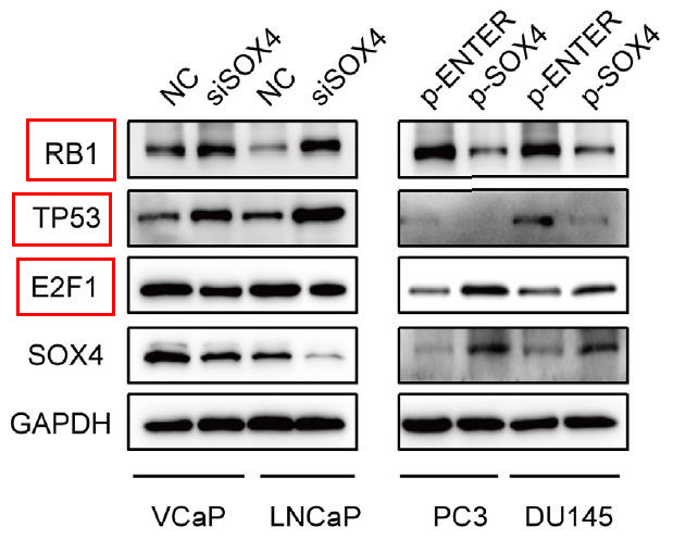 E2F1 Ab