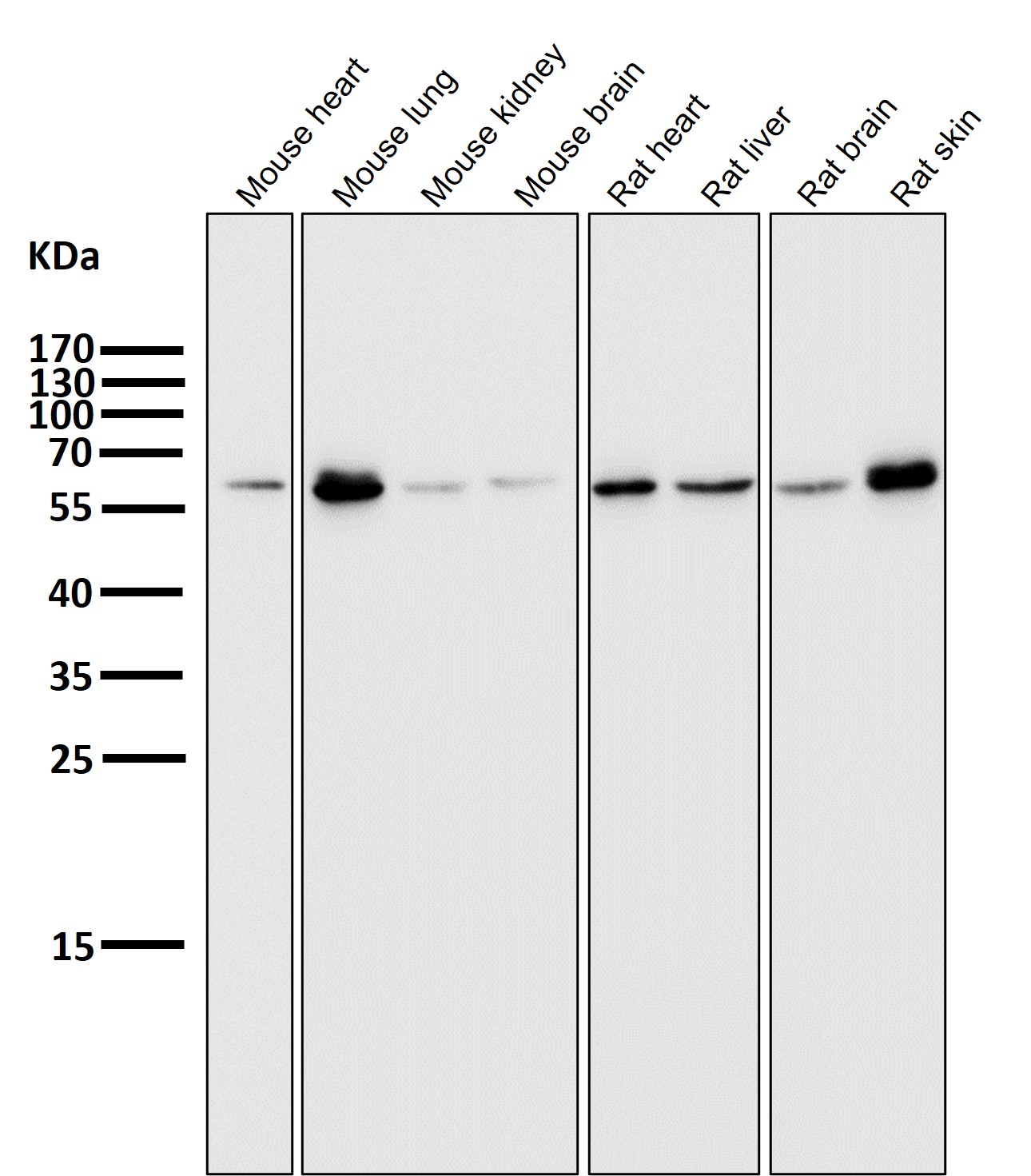 E2F1 Ab