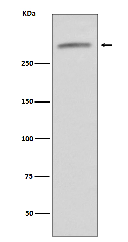 von Willebrand factor Ab