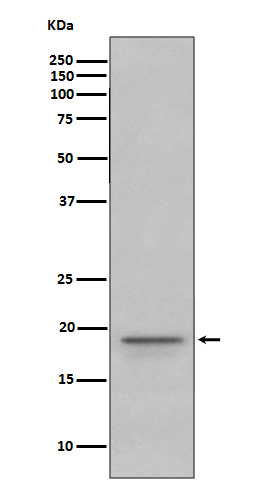 Myelin basic protein Ab