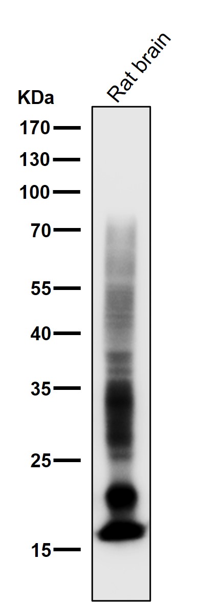 Myelin basic protein Ab