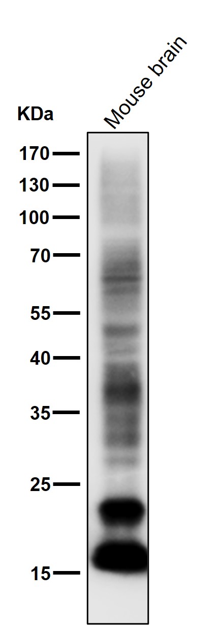 Myelin basic protein Ab