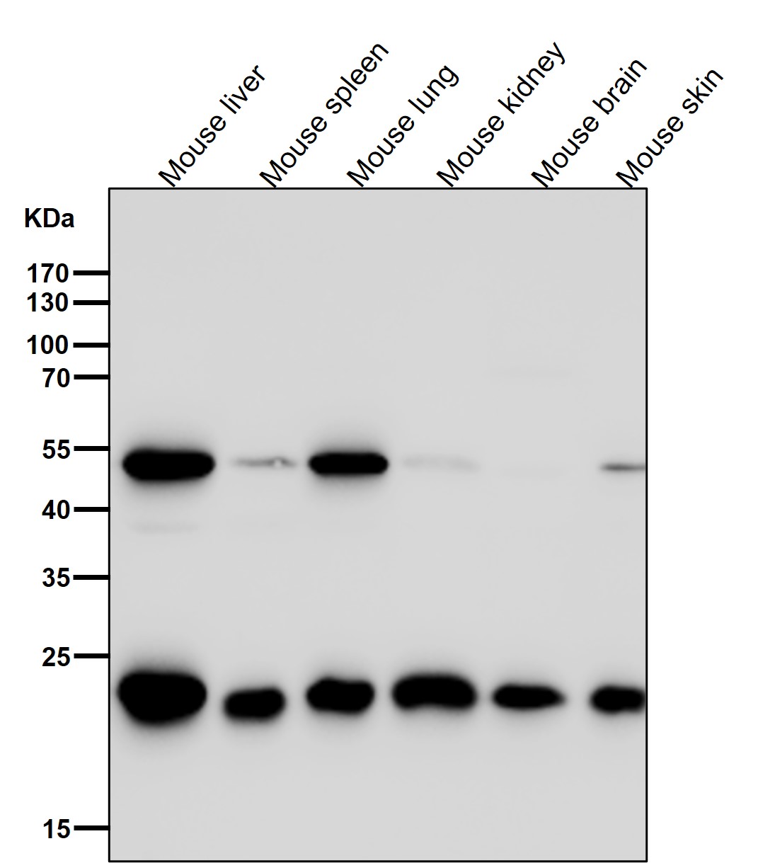 Peroxiredoxin 1 Ab