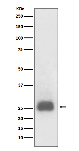 TIMP1 Ab