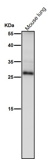 TIMP1 Ab