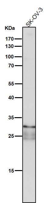 TIMP1 Ab