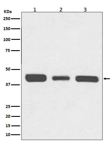 RPSA Ab