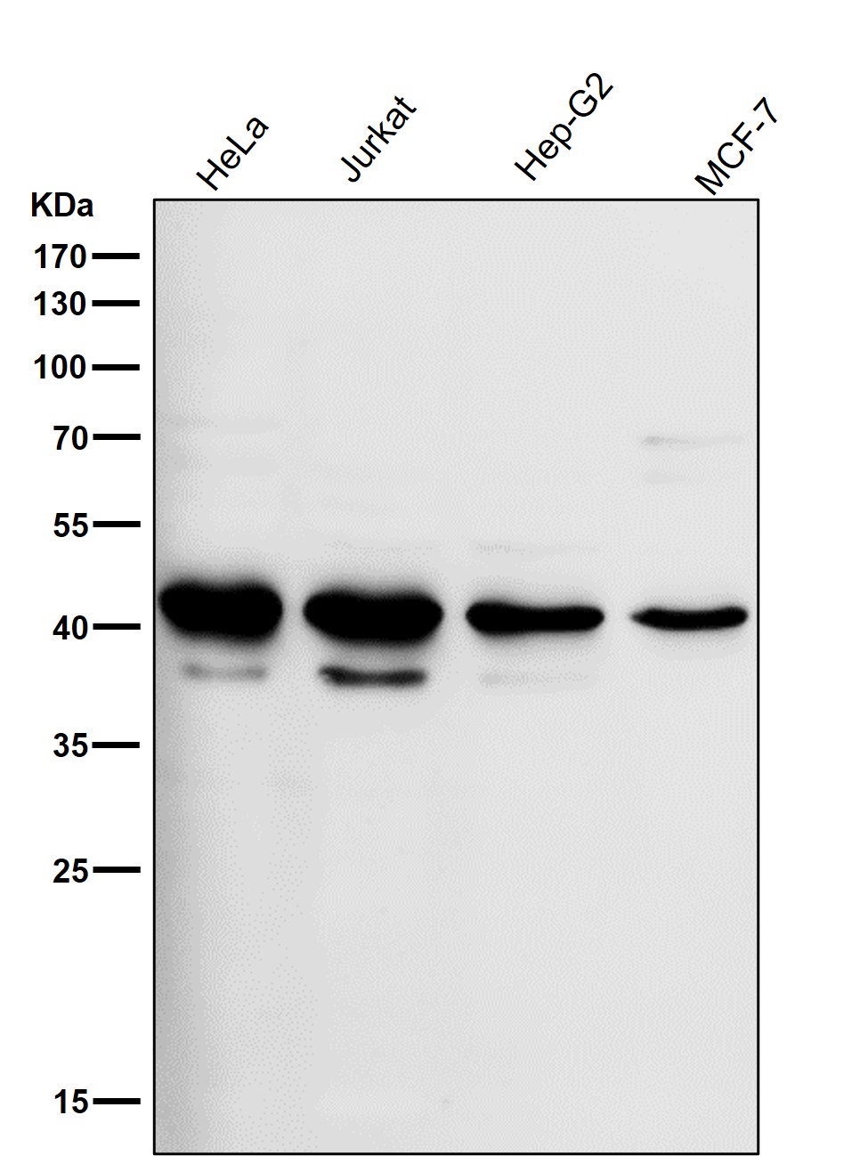 RPSA Ab