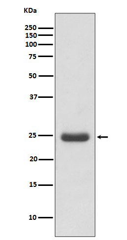 Thymidine kinase Ab