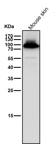 gamma Catenin Ab