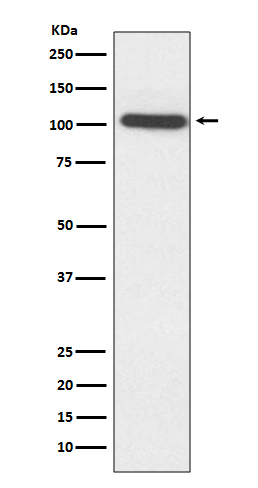 alpha Actinin 2 Ab