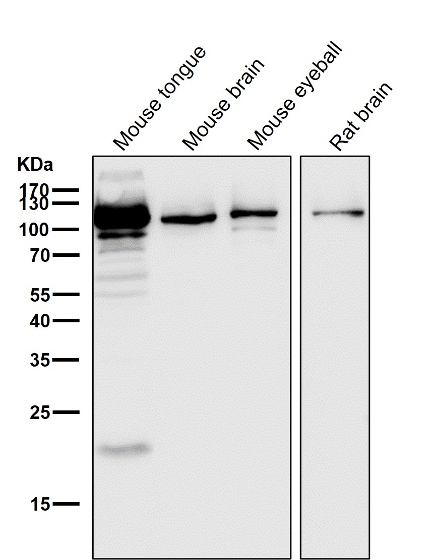 alpha Actinin 2 Ab