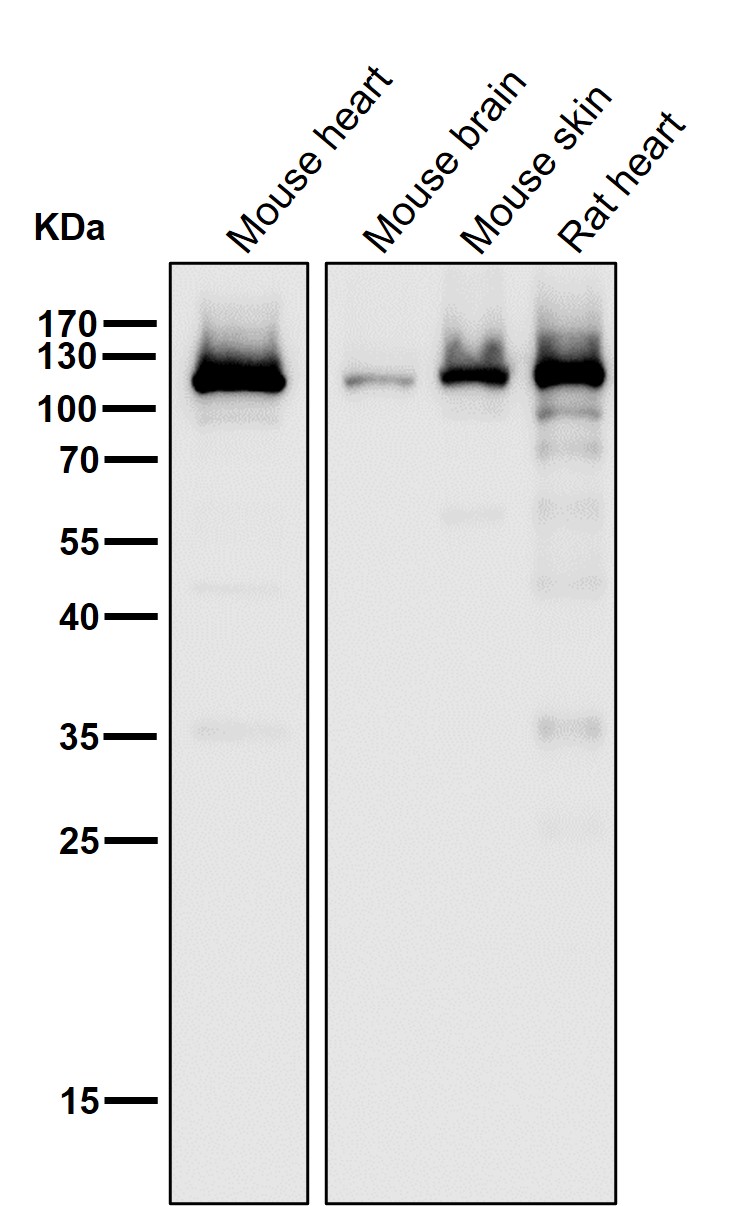 alpha Actinin 2 Ab