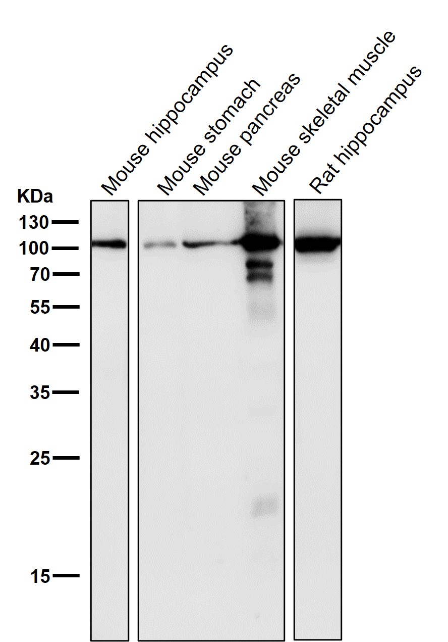 alpha Actinin 2 Ab