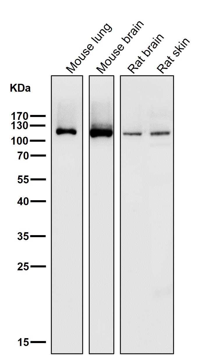 alpha Actinin 2 Ab