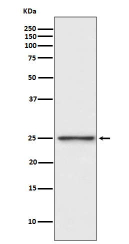 PGP9.5 Ab