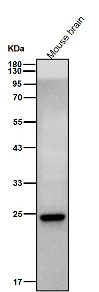 PGP9.5 Ab