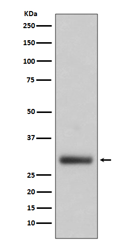 Neutrophil elastase Ab