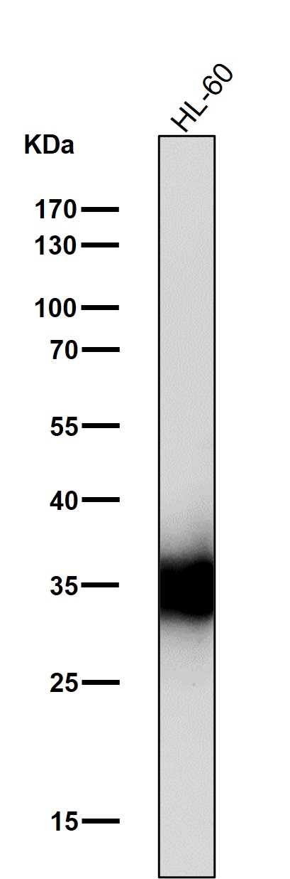 Neutrophil elastase Ab