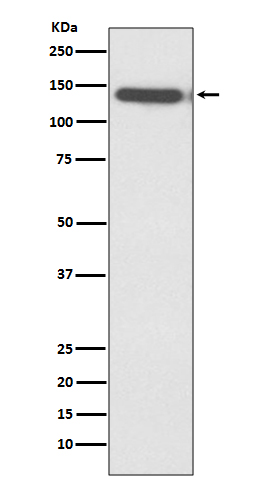 BCL 11B Ab